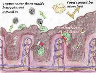 drawing_bad_intestines_4